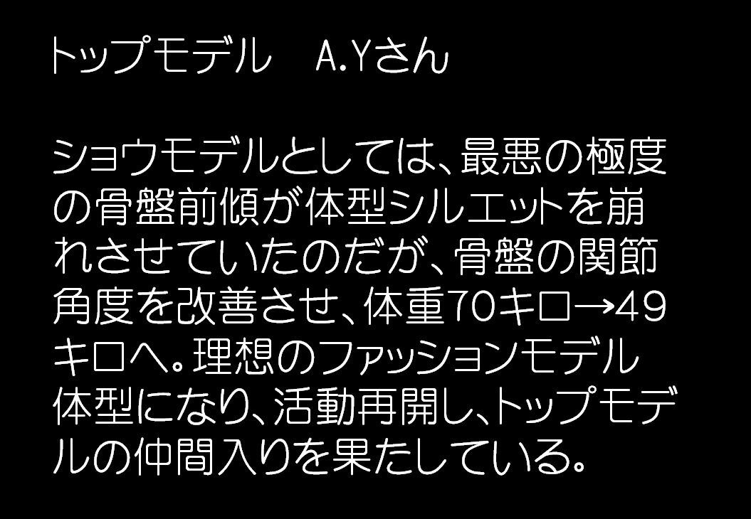 トップモデル　A.Yさん、ショウモデルとしては、最悪の極度の骨盤前傾が体型　シェイプス　Shapes ボディメイクジム