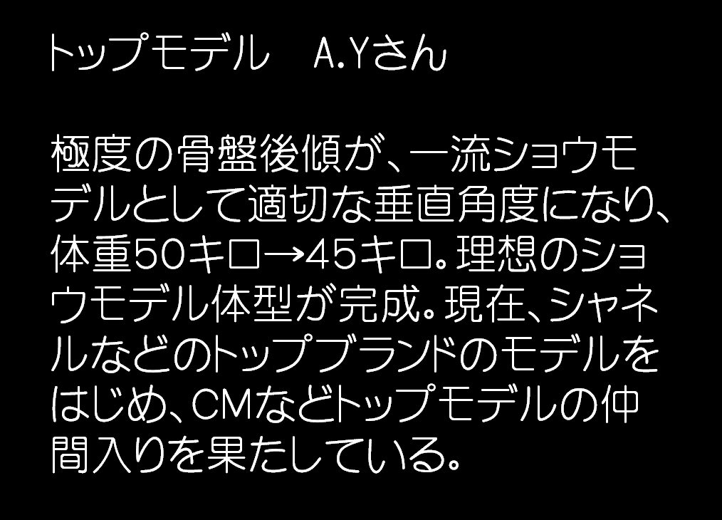 シセトレをしたトップモデルA.Yは、極度の骨盤後傾が、一流ショウモデルとして適切な垂直角度になり、体重５０キロ→４５キロ。理想のショウモデル体型が完成　シェイプス　Shapes ボディメイクジム