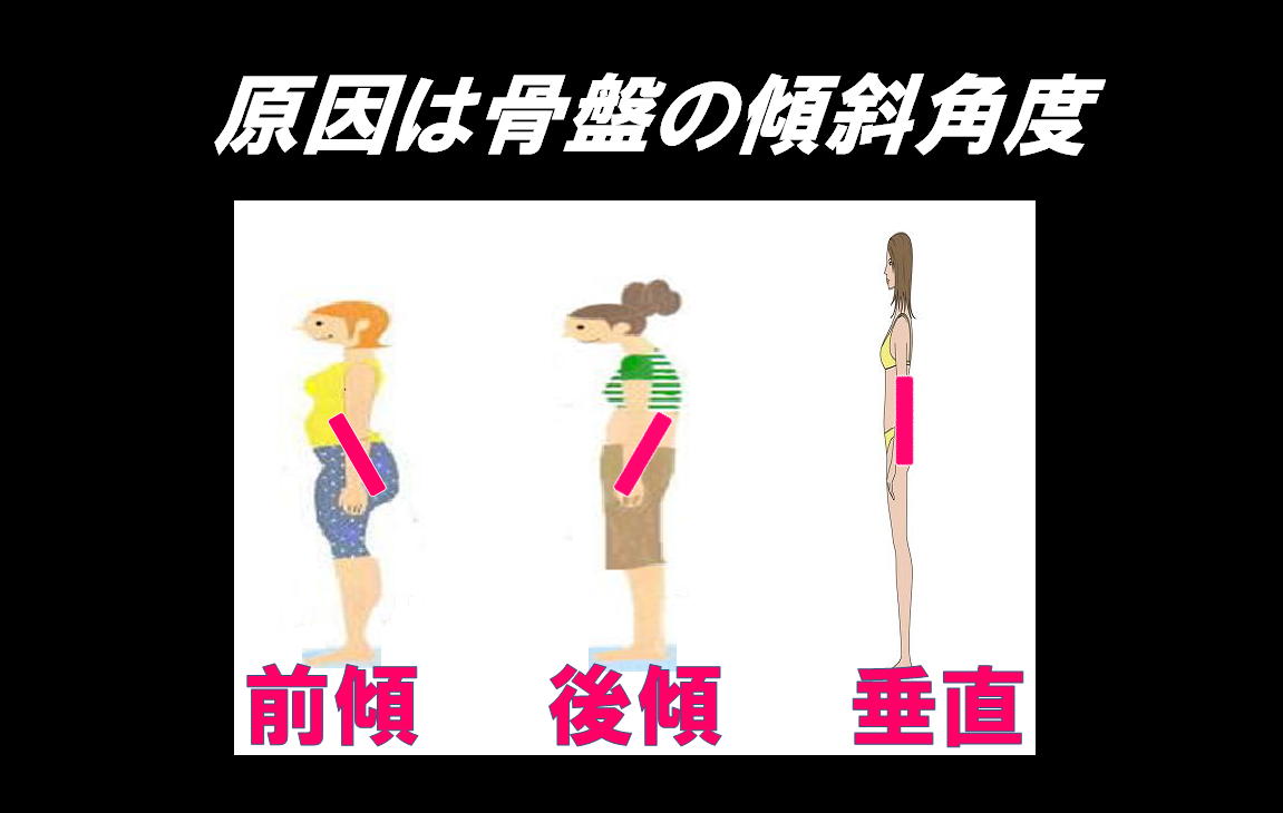 しせとれの骨盤傾斜角度と骨盤前傾と骨盤後傾と骨盤垂直｜シセトレ　姿勢トレ　ダイエット　シェイプスShapes